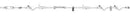IV Pump Set Infusomat Space Pump 3 Ports 15 Drops / mL Drip Rate Without Filter 120 Inch Tubing Solution | B. Braun Medical | SurgiMac