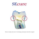 SEcure Resin Cement System | S270 | | Cosmetic Dentistry, Dental, Dental Supplies | Parkell | SurgiMac