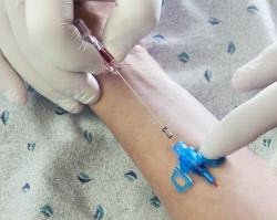 Closed IV Catheter Introcan Safety 3 20 Gauge 1 Inch Sliding Safety Needle | B. Braun Medical | SurgiMac