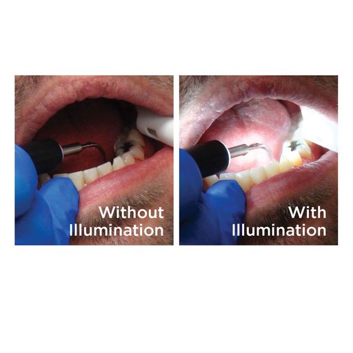 TurboVue Triple-Bend Light-Transmitting Insert | DLH30TRI | | Air polishers & accessories, Dental, Dental Equipment, Ultrasonic Inserts, Ultrasonic scalers | Parkell | SurgiMac