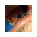 20/20 Double-Sided Mirrors by Parkell (6 pcs) | S475 | | Dental Supplies, Diagnostic Instruments, Instruments, Mouth Mirrors | Parkell | SurgiMac