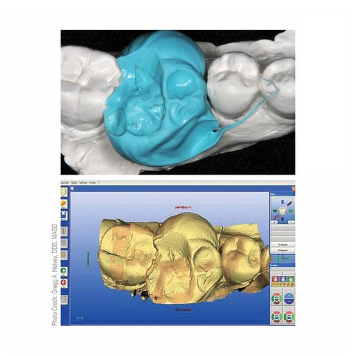 Blu-Mousse Classic Peppermint (2-Min. Set) | S437S | | Bite registration, Dental, Dental Supplies, Impression materials | Parkell | SurgiMac