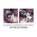 Amalgambond Plus Complete Kit | S370 | | Bonding agents, Cosmetic Dentistry, Dental, Dental Supplies | Parkell | SurgiMac